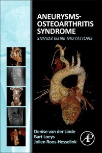 ANEURYSMS-OSTEOARTHRITIS SYNDROME