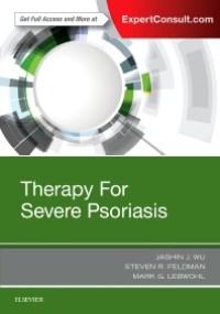 Therapy For Severe Psoriasis